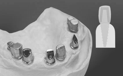 Piliers Télescopiques