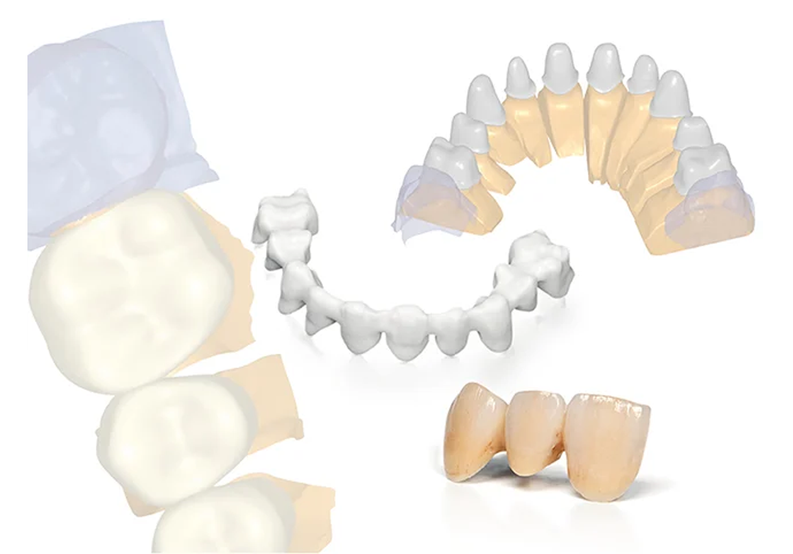Cad Cam Souss Dentistic