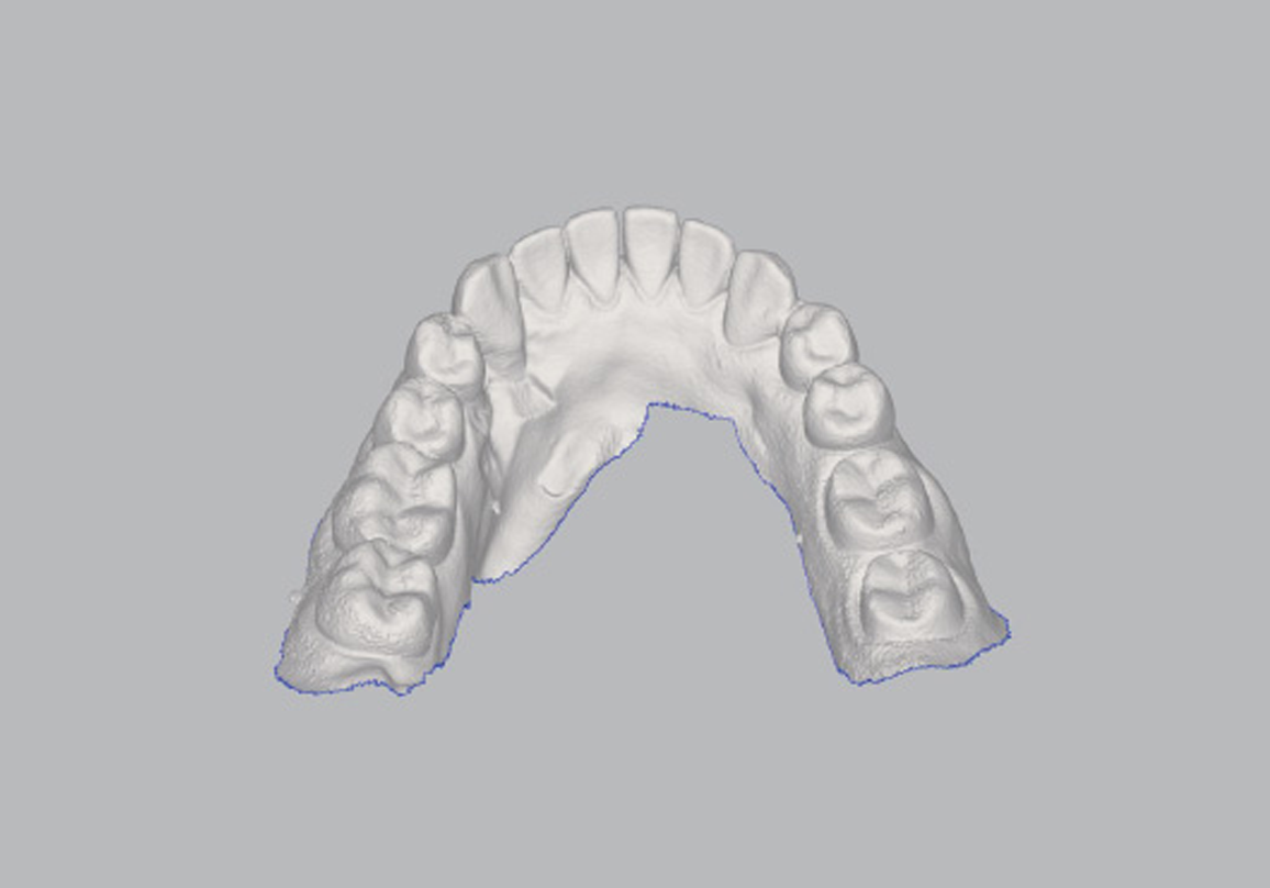 Cad Cam Souss Dentistic