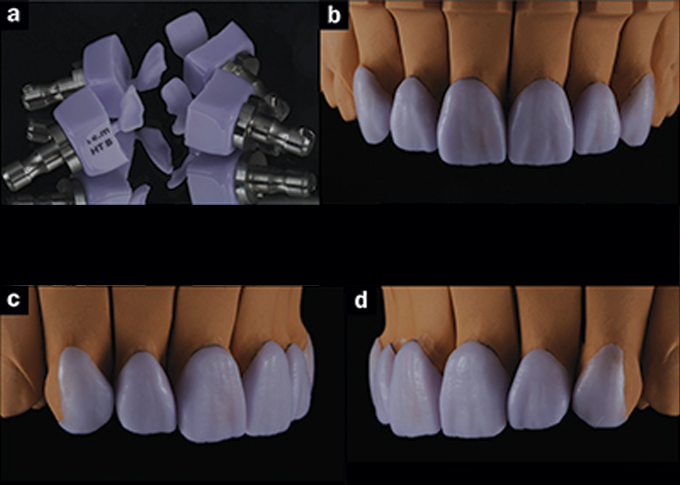 Prothésiste Dentaire à Agadir