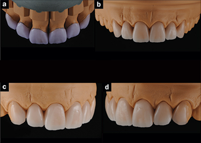 Prothésiste Dentaire à Agadir