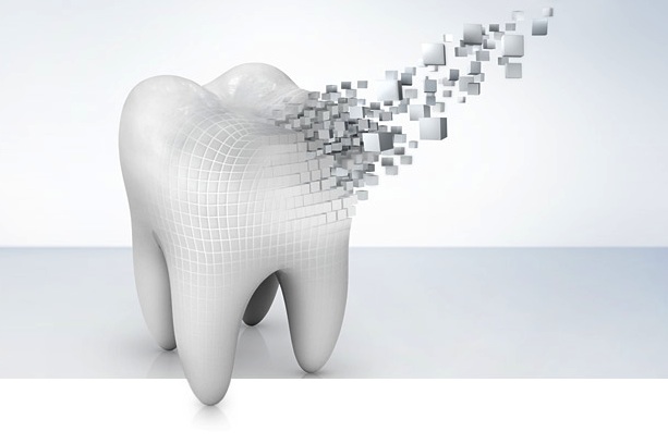 Prothèse de Précision