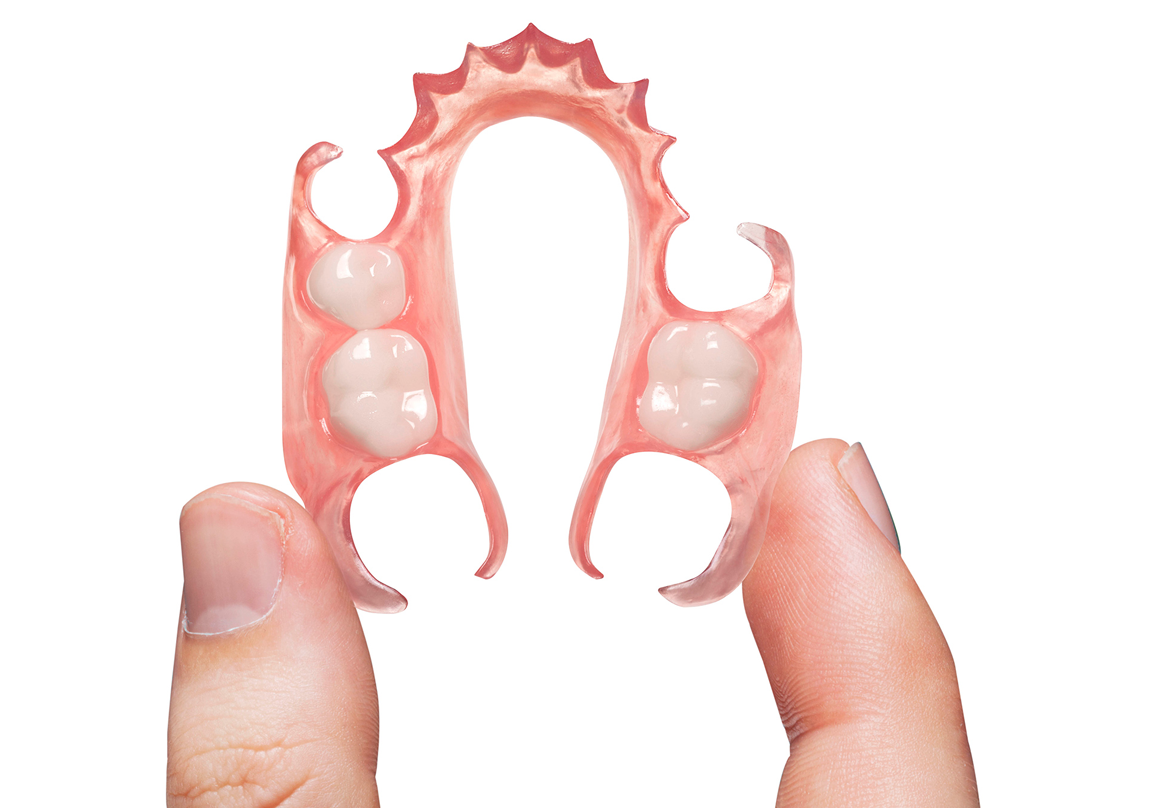 Prothèses Amovibles Flexibles