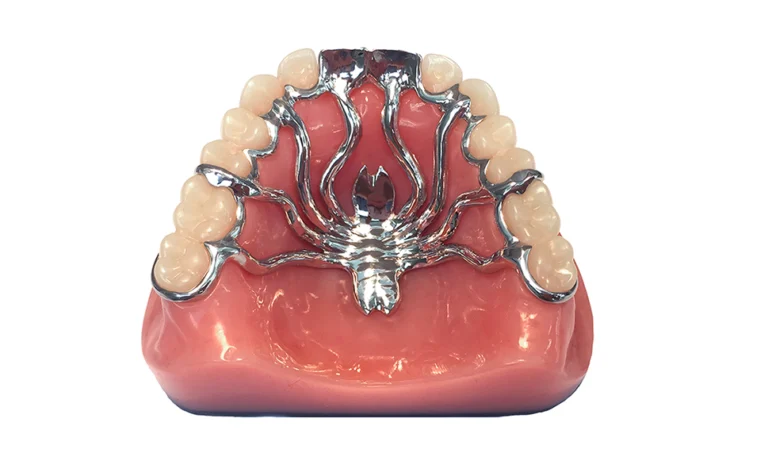 Prothèses Amovibles a agadir, Maroc