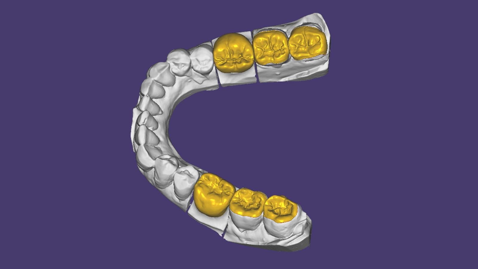 Souss Dentistic CFAO agadir