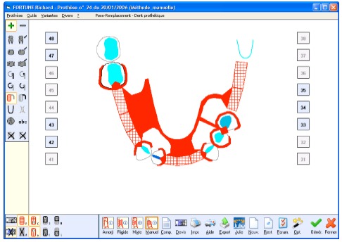 Appareils dentaires Agadir