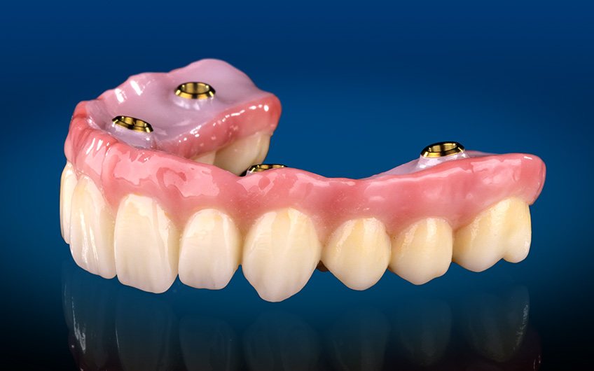 Zircone Souss Dentistic