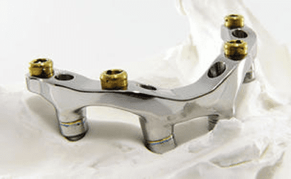 Barres Pour Prothèses